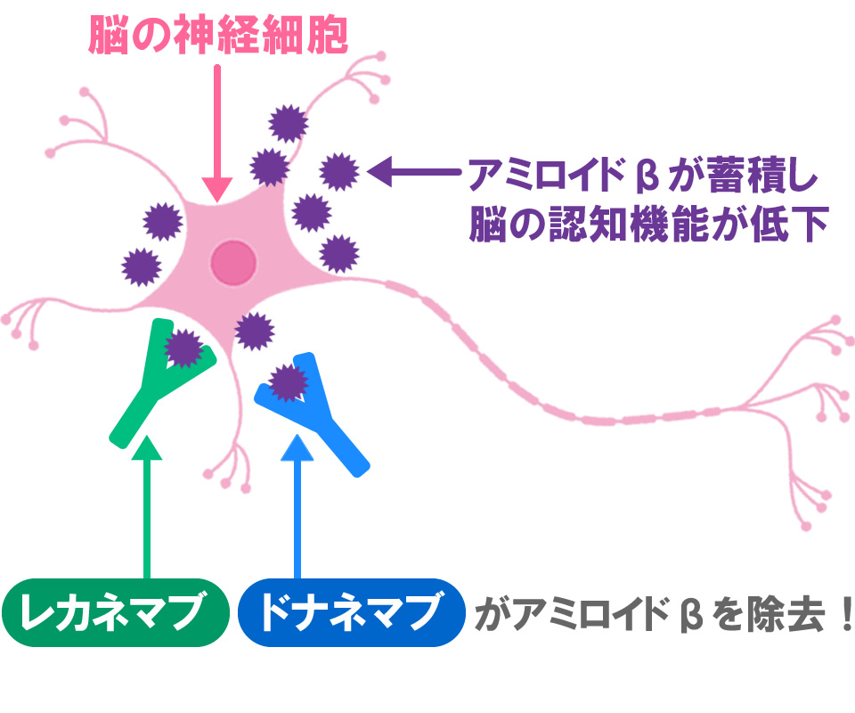 『レカネマブ』『ドナネマブ』はアミロイドβを取り除きます。