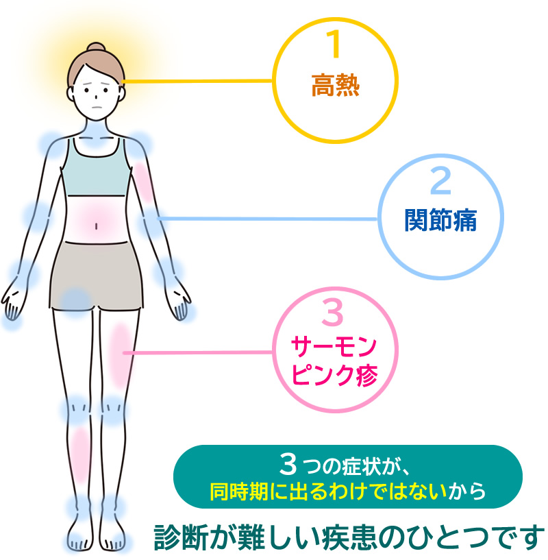 成人発症スチル病