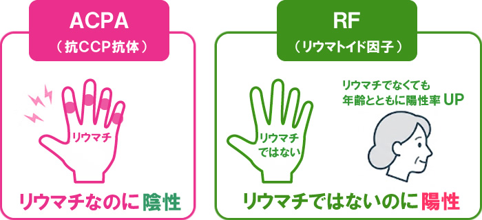 ACPA（抗CCP抗体）とRF（リウマトイド因子）の比較のイラスト