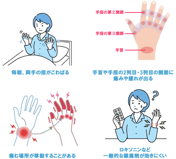 関節リウマチの代表的な症状のイラスト